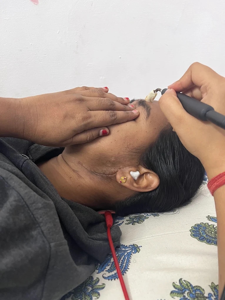 Specialized Facial Physiotherapy